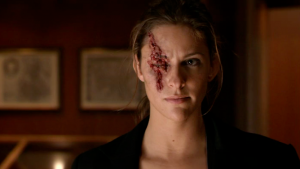 Krista missing an eye Krista missing an eye